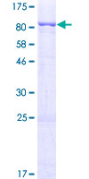 ABHD16A / BAT5 Protein - 12.5% SDS-PAGE of human BAT5 stained with Coomassie Blue