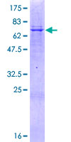 ABHD16B / C20orf135 Protein - 12.5% SDS-PAGE of human C20orf135 stained with Coomassie Blue