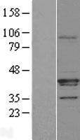 ABHD17A / FAM108A1 Protein - Western validation with an anti-DDK antibody * L: Control HEK293 lysate R: Over-expression lysate