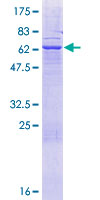 ABHD17A / FAM108A1 Protein - 12.5% SDS-PAGE of human FAM108A1 stained with Coomassie Blue