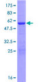 ABHD17B / FAM108B1 Protein - 12.5% SDS-PAGE of human FAM108B1 stained with Coomassie Blue