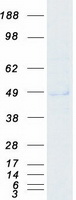 ABHD2 Protein - Purified recombinant protein ABHD2 was analyzed by SDS-PAGE gel and Coomassie Blue Staining