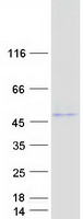 ABHD3 Protein - Purified recombinant protein ABHD3 was analyzed by SDS-PAGE gel and Coomassie Blue Staining