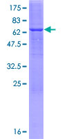 ABHD4 Protein - 12.5% SDS-PAGE of human ABHD4 stained with Coomassie Blue