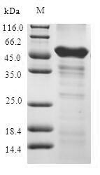 ABHD5 Protein - (Tris-Glycine gel) Discontinuous SDS-PAGE (reduced) with 5% enrichment gel and 15% separation gel.