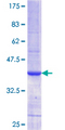 ABHD5 Protein - 12.5% SDS-PAGE Stained with Coomassie Blue.