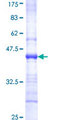 ABHD5 Protein - 12.5% SDS-PAGE Stained with Coomassie Blue.
