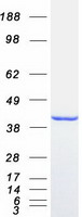 ABHD5 Protein - Purified recombinant protein ABHD5 was analyzed by SDS-PAGE gel and Coomassie Blue Staining