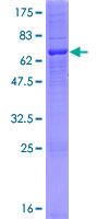 ABHD6 Protein - 12.5% SDS-PAGE of human ABHD6 stained with Coomassie Blue