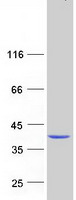 ABHD6 Protein - Purified recombinant protein ABHD6 was analyzed by SDS-PAGE gel and Coomassie Blue Staining