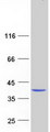 ABHD6 Protein - Purified recombinant protein ABHD6 was analyzed by SDS-PAGE gel and Coomassie Blue Staining
