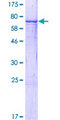 ABHD8 Protein - 12.5% SDS-PAGE of human ABHD8 stained with Coomassie Blue