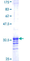 ABI1 / SSH3BP1 Protein - 12.5% SDS-PAGE Stained with Coomassie Blue.