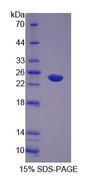 ABI1 / SSH3BP1 Protein - Recombinant  Abl Interactor 1 By SDS-PAGE