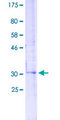 ABL1 / c-ABL Protein - 12.5% SDS-PAGE Stained with Coomassie Blue.
