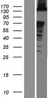 ABL2 Protein - Western validation with an anti-DDK antibody * L: Control HEK293 lysate R: Over-expression lysate