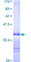 ABL2 Protein - 12.5% SDS-PAGE Stained with Coomassie Blue.