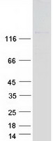 ABL2 Protein - Purified recombinant protein ABL2 was analyzed by SDS-PAGE gel and Coomassie Blue Staining