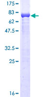 ABLIM1 Protein - 12.5% SDS-PAGE of human ABLIM1 stained with Coomassie Blue