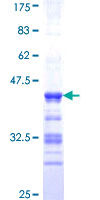 ABLIM1 Protein - 12.5% SDS-PAGE Stained with Coomassie Blue.