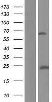 ABLIM2 Protein - Western validation with an anti-DDK antibody * L: Control HEK293 lysate R: Over-expression lysate