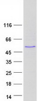 ABLIM2 Protein - Purified recombinant protein ABLIM2 was analyzed by SDS-PAGE gel and Coomassie Blue Staining