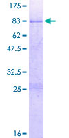 ABLIM3 Protein - 12.5% SDS-PAGE of human ABLIM3 stained with Coomassie Blue