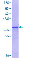 ABO Glycosyltransferase Protein - 12.5% SDS-PAGE Stained with Coomassie Blue.