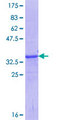ABO Glycosyltransferase Protein - 12.5% SDS-PAGE Stained with Coomassie Blue.