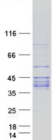 ABO Glycosyltransferase Protein - Purified recombinant protein ABO was analyzed by SDS-PAGE gel and Coomassie Blue Staining