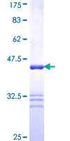 ABP-280 / FLNC Protein - 12.5% SDS-PAGE Stained with Coomassie Blue.