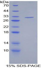 ABP-280 / FLNC Protein - Recombinant Filamin C Gamma By SDS-PAGE