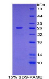 ABP-280 / FLNC Protein - Recombinant Filamin C Gamma By SDS-PAGE