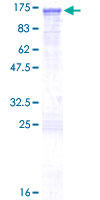 ABR Protein - 12.5% SDS-PAGE of human ABR stained with Coomassie Blue