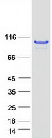 ABR Protein - Purified recombinant protein ABR was analyzed by SDS-PAGE gel and Coomassie Blue Staining