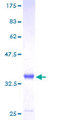 ABRACL Protein - 12.5% SDS-PAGE of human C6orf115 stained with Coomassie Blue