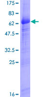 ABRI / ITM2B Protein - 12.5% SDS-PAGE of human ITM2B stained with Coomassie Blue