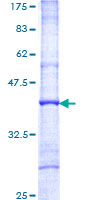 ABRI / ITM2B Protein - 12.5% SDS-PAGE Stained with Coomassie Blue.