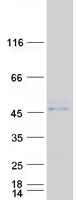 ABRI / ITM2B Protein - Purified recombinant protein ITM2B was analyzed by SDS-PAGE gel and Coomassie Blue Staining