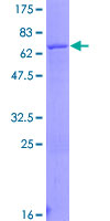 ACAA1 Protein - 12.5% SDS-PAGE of human ACAA1 stained with Coomassie Blue