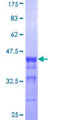 ACAA1 Protein - 12.5% SDS-PAGE Stained with Coomassie Blue.