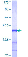 ACAA2 Protein - 12.5% SDS-PAGE Stained with Coomassie Blue.