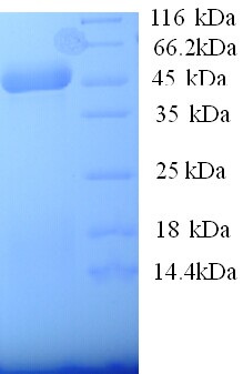 ACAA2 Protein