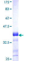 ACACB / ACC2 Protein - 12.5% SDS-PAGE Stained with Coomassie Blue.