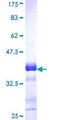 ACACB / ACC2 Protein - 12.5% SDS-PAGE Stained with Coomassie Blue.