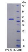 ACACB / ACC2 Protein - Recombinant Acetyl Coenzyme A Carboxylase Beta (ACACb) by SDS-PAGE