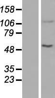 ACAD10 Protein - Western validation with an anti-DDK antibody * L: Control HEK293 lysate R: Over-expression lysate