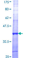 ACAD11 Protein - 12.5% SDS-PAGE Stained with Coomassie Blue.