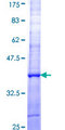 ACAD11 Protein - 12.5% SDS-PAGE Stained with Coomassie Blue.