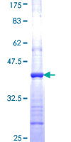 ACAD8 Protein - 12.5% SDS-PAGE Stained with Coomassie Blue.